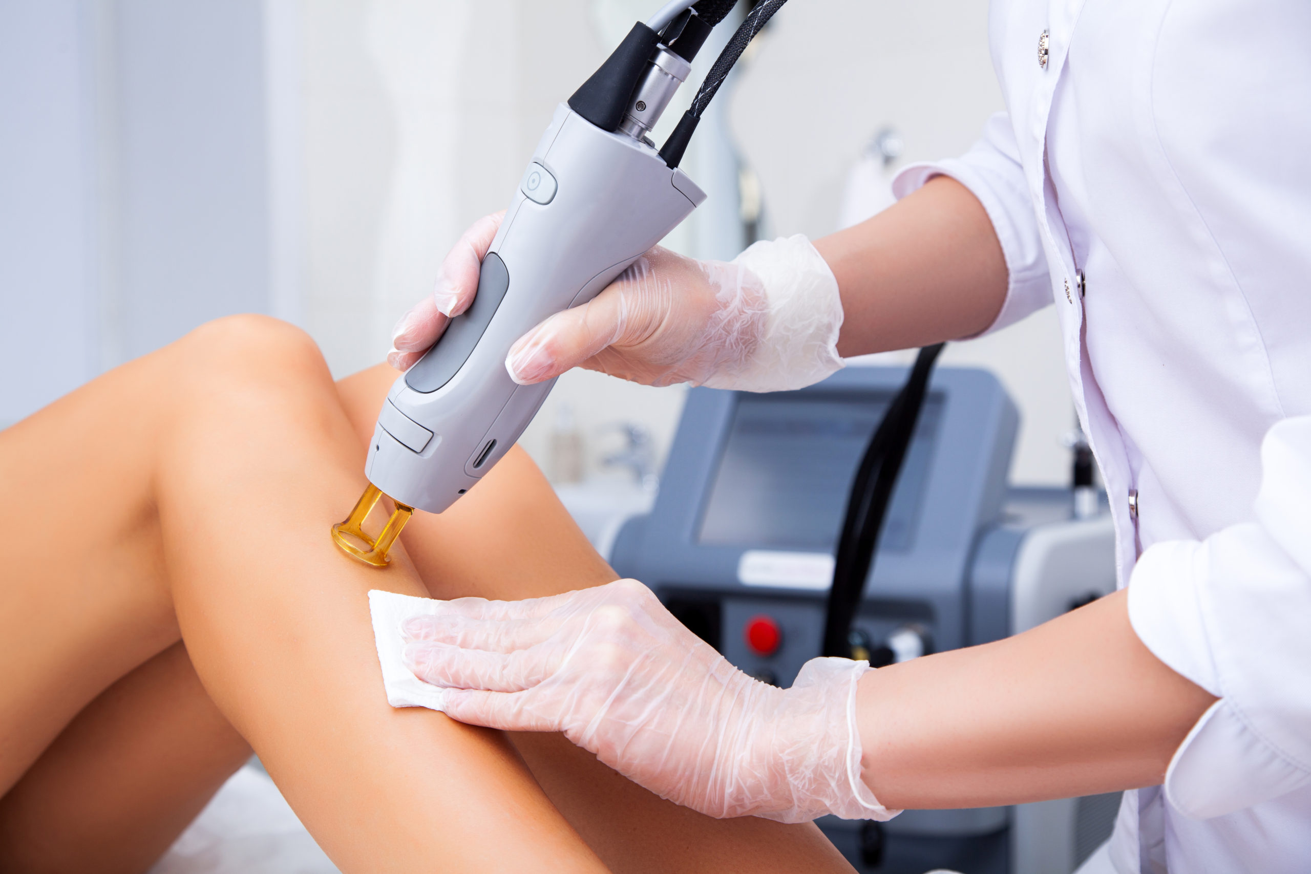 Watertown NY Laser Hair Removal: Signs You Might Need To Get It Done